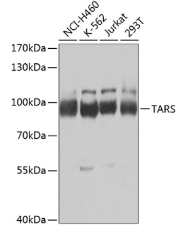 TARS Rabbit Polyclonal Antibody