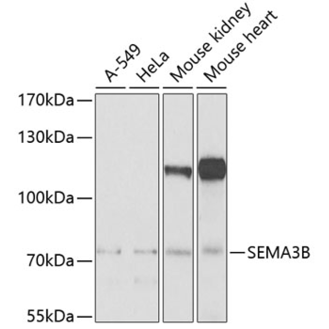 SEMA3B Rabbit Polyclonal Antibody