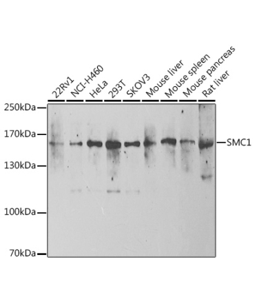 SMC1 Rabbit Polyclonal Antibody