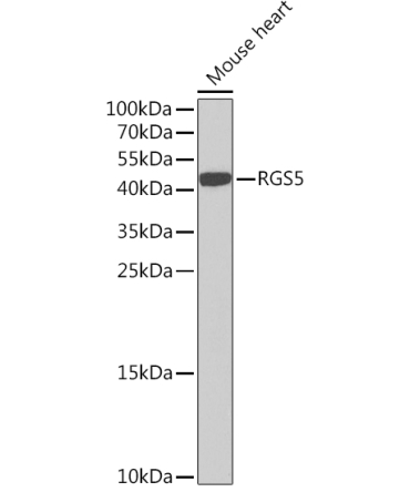 RGS5 Rabbit Polyclonal Antibody