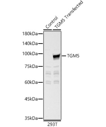 TGM5 Rabbit Polyclonal Antibody