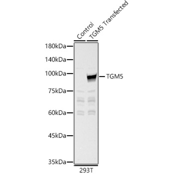TGM5 Rabbit Polyclonal Antibody