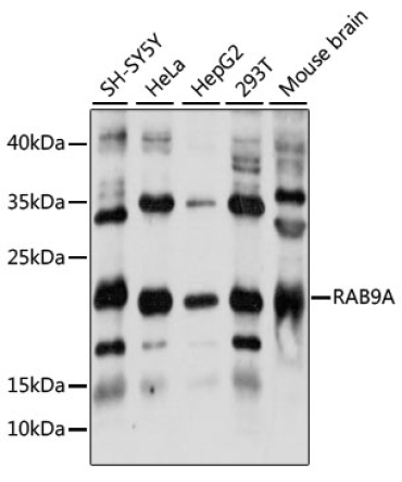 RAB9A Rabbit Polyclonal Antibody