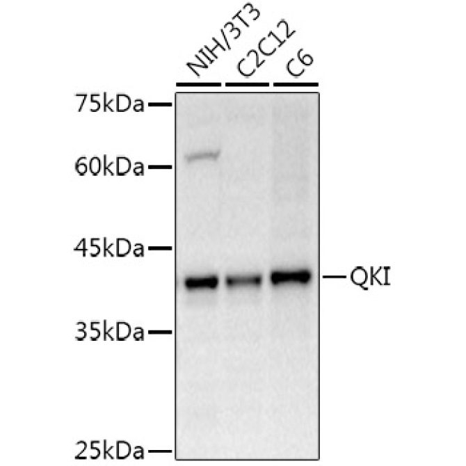 QKI Rabbit Polyclonal Antibody