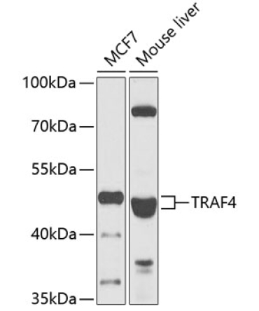 TRAF4 Rabbit Polyclonal Antibody