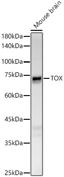 TOX Rabbit Polyclonal Antibody
