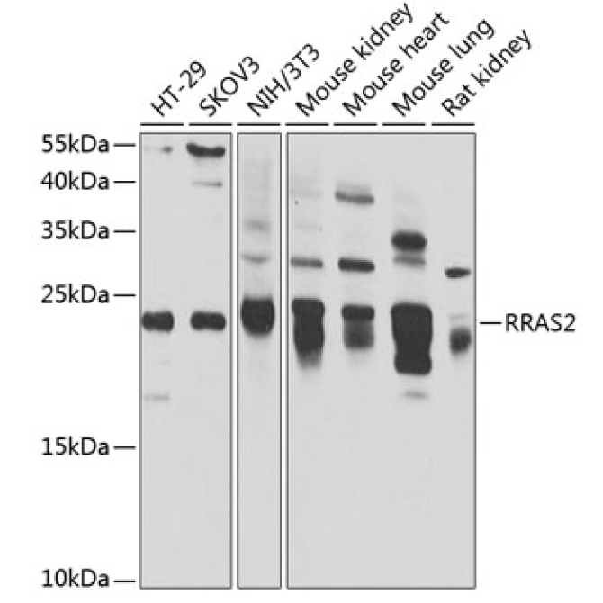 RRAS2 Rabbit Polyclonal Antibody