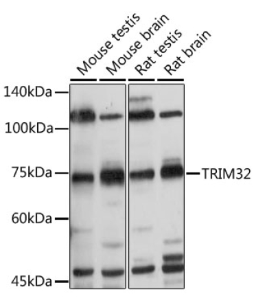 TRIM32 Rabbit Polyclonal Antibody