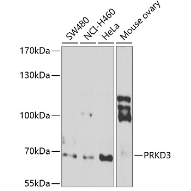 PRKD3 Rabbit Polyclonal Antibody