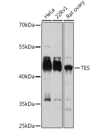 TES Rabbit Polyclonal Antibody