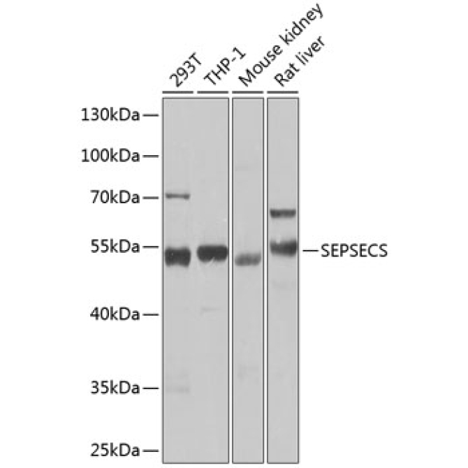 SEPSECS Rabbit Polyclonal Antibody