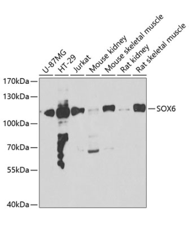SOX6 Rabbit Polyclonal Antibody