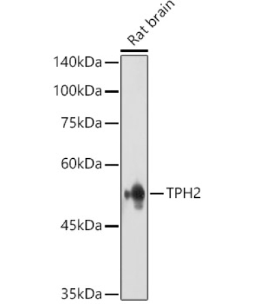 TPH2 Rabbit Polyclonal Antibody