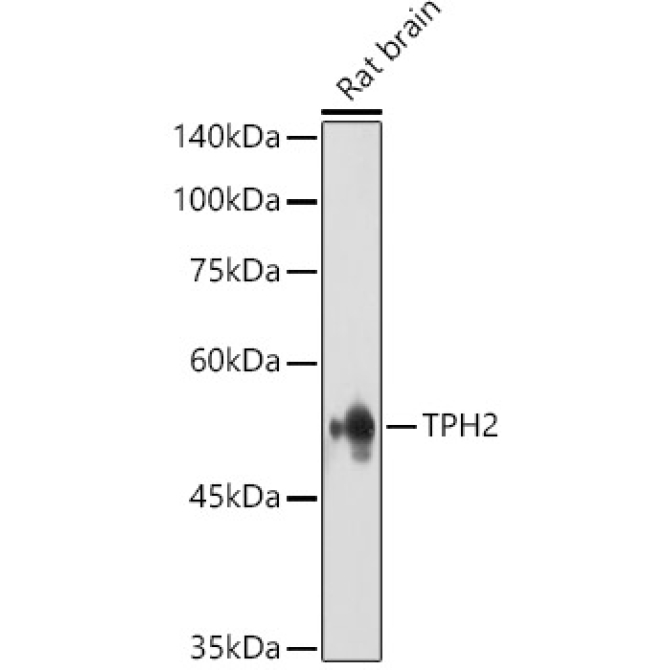 TPH2 Rabbit Polyclonal Antibody