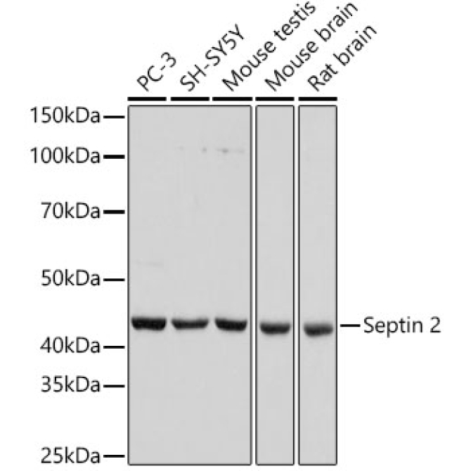 Septin 2 Rabbit Monoclonal Antibody