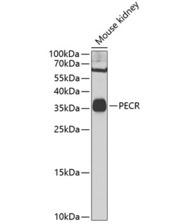 PECR Rabbit Polyclonal Antibody