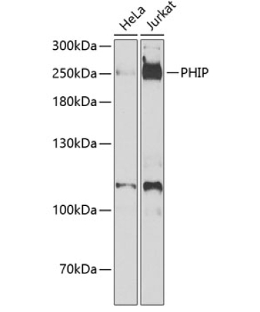 PHIP Rabbit Polyclonal Antibody