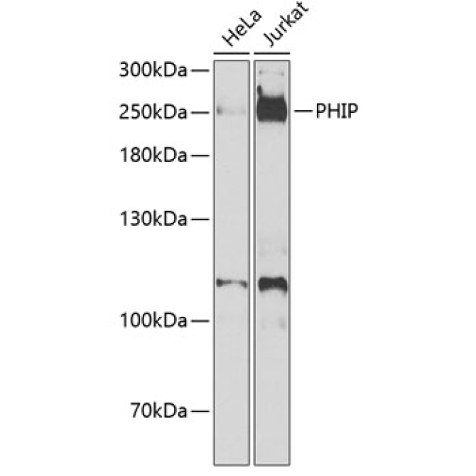 PHIP Rabbit Polyclonal Antibody