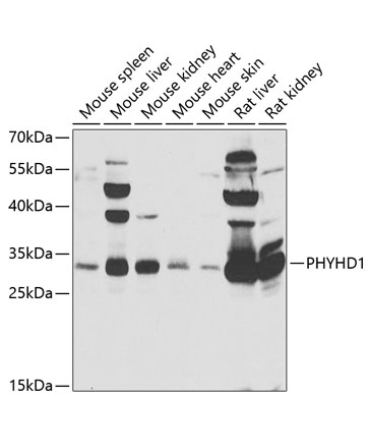 PHYHD1 Rabbit Polyclonal Antibody