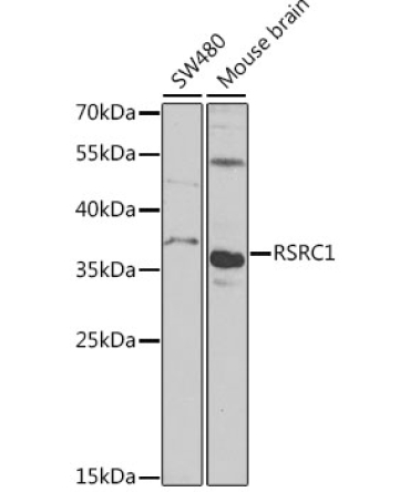 RSRC1 Rabbit Polyclonal Antibody