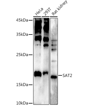 SAT2 Rabbit Polyclonal Antibody
