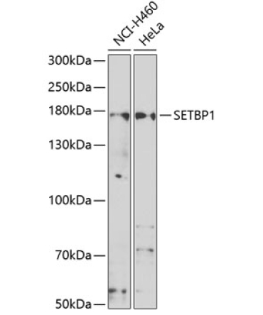 SETBP1 Rabbit Polyclonal Antibody