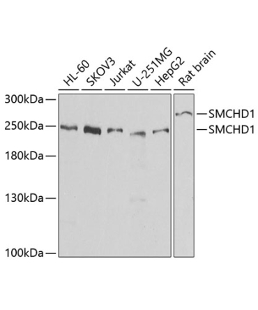 SMCHD1 Rabbit Polyclonal Antibody