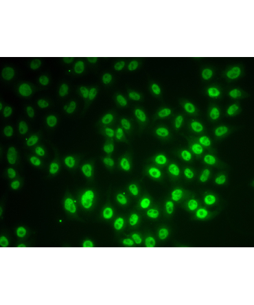 SNRPD1 Rabbit Polyclonal Antibody