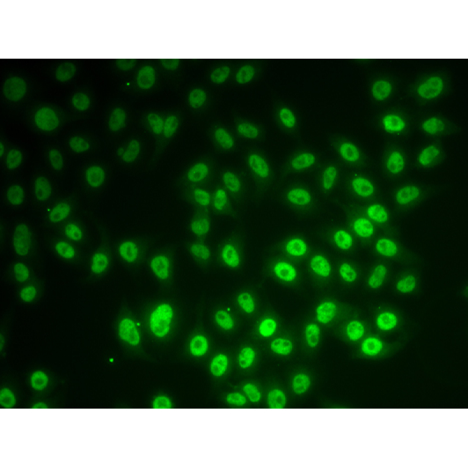 SNRPD1 Rabbit Polyclonal Antibody