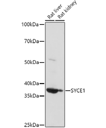 SYCE1 Rabbit Polyclonal Antibody