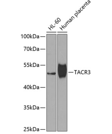 TACR3 Rabbit Polyclonal Antibody
