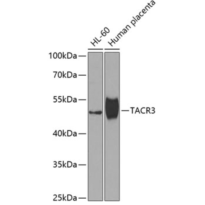 TACR3 Rabbit Polyclonal Antibody