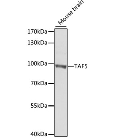 TAF5 Rabbit Polyclonal Antibody