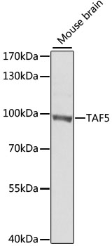 TAF5 Rabbit Polyclonal Antibody