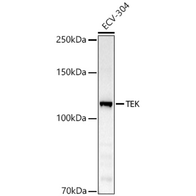 TEK Rabbit Polyclonal Antibody