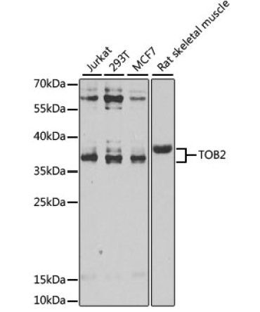 TOB2 Rabbit Polyclonal Antibody
