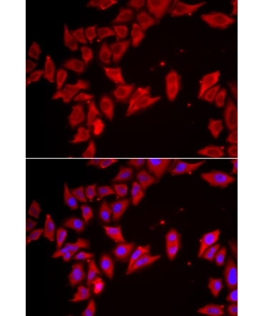 SLC35A2 Rabbit Polyclonal Antibody