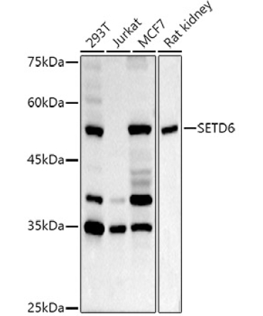 SETD6 Rabbit Polyclonal Antibody