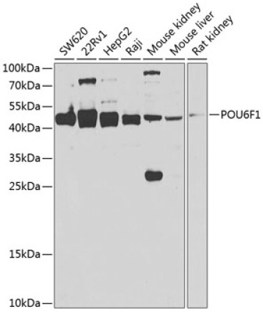 POU6F1 Rabbit Polyclonal Antibody