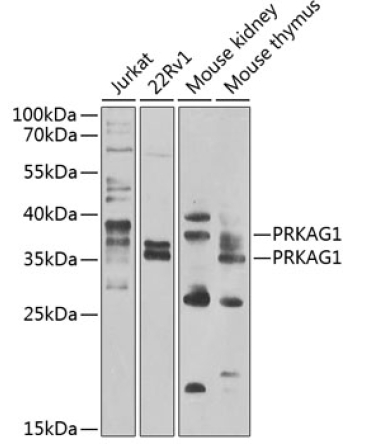 PRKAG1 Rabbit Polyclonal Antibody