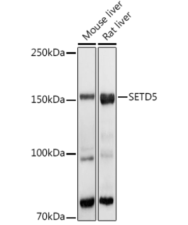 SETD5 Rabbit Polyclonal Antibody