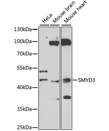 SMYD3 Rabbit Polyclonal Antibody