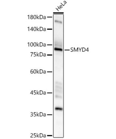 SMYD4 Rabbit Polyclonal Antibody