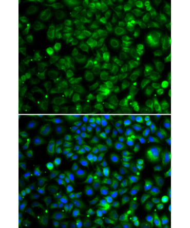 TMLHE Rabbit Polyclonal Antibody