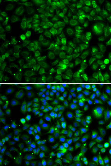 TMLHE Rabbit Polyclonal Antibody