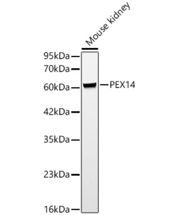 PEX14 Rabbit Polyclonal Antibody