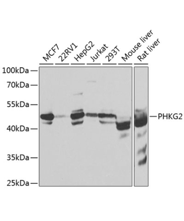 PHKG2 Rabbit Polyclonal Antibody