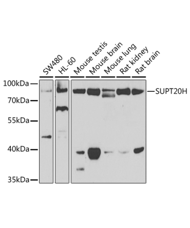 SUPT20H Rabbit Polyclonal Antibody