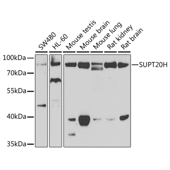 SUPT20H Rabbit Polyclonal Antibody