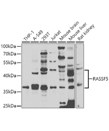 RASSF5 Rabbit Polyclonal Antibody